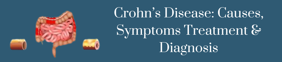 Crohn's Disease